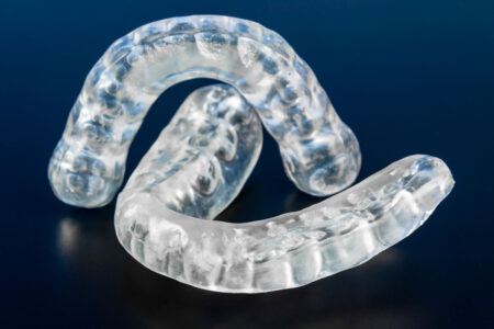 invisalign-2